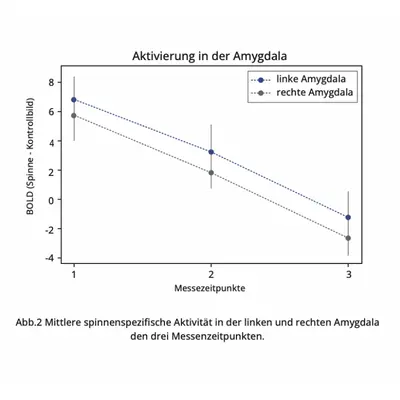 Aktivierung Amygdala